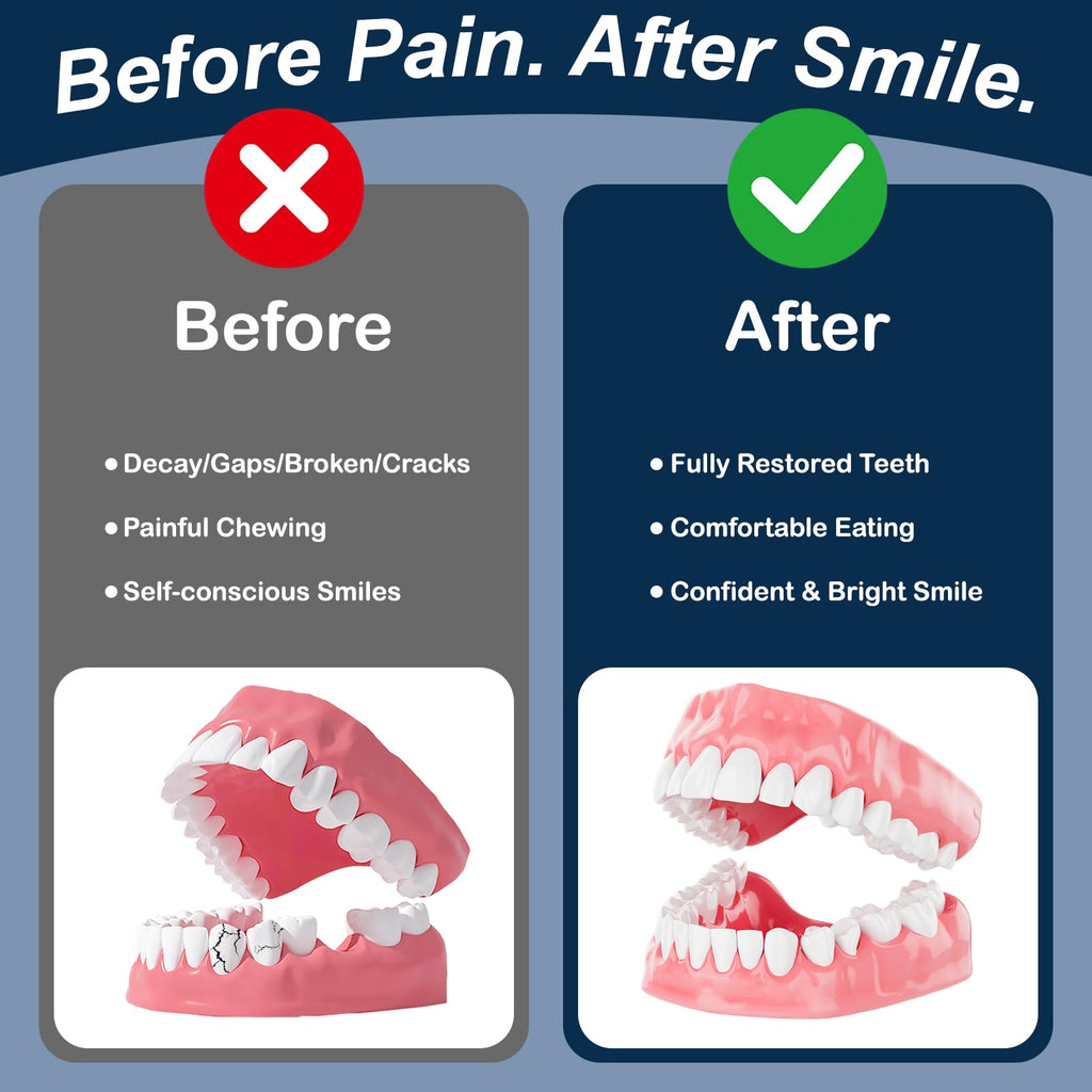 Denture Repair Glue 1oz Fast-Setting Adhesive L335813